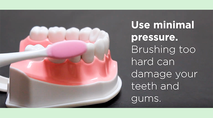 Use minimal pressure. Brushing too hard can damage your teeth and gums